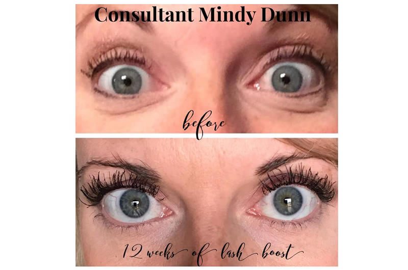 Rodan And Fields Lash Serum Before And After