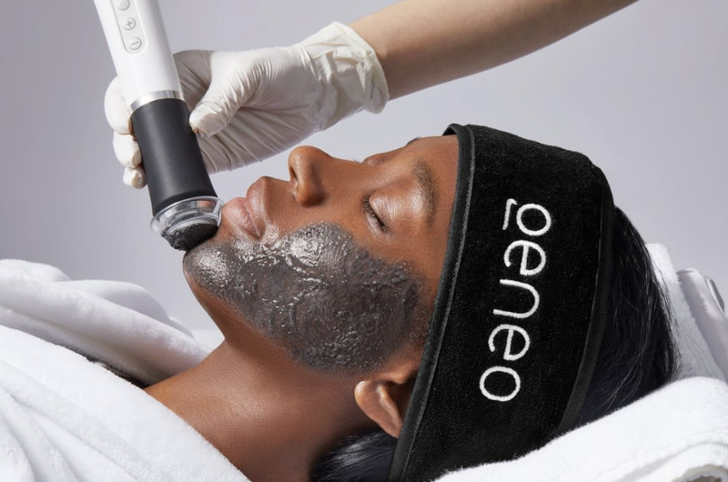 New Non-Invasive Treatment Bound To Enhance That Bridal Glow Face